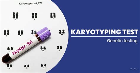 Karyotyping Test Purpose And Procedure