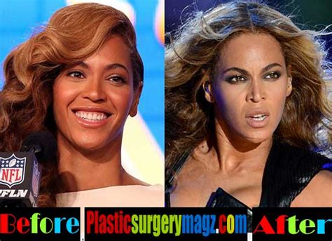 Beyonce Plastic Surgery Before And After Plastic Surgery Magazine
