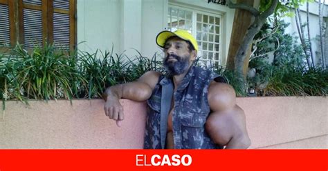 Muere El Famoso Hulk Brasileño De Un Paro Cardíaco Después De Inyectarse Esteroides En Los Brazos