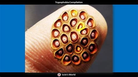 worlds longest trypophobia compilation  compilation