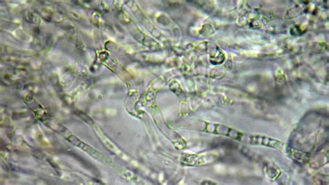 Fangi Mushroom Cells Under Microscope Stock Footage Video 4946135