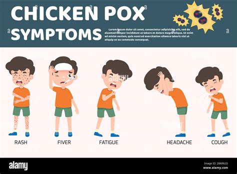 Children Has Chicken Pox Infographic Poster Children Fever And