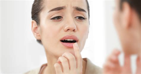 What Having Lupus Mouth Sores Feels Like And How They Can Be Treated 2023