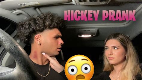 Hickey Prank On My Crush 😳 Gone Wrong Youtube