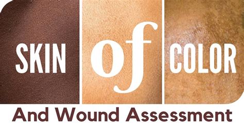 Wound Assessment Skin Of Many Colors Wcei Blog Wcei Blog