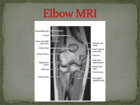 Elbow Anatomy Mri Anatomical Charts And Posters