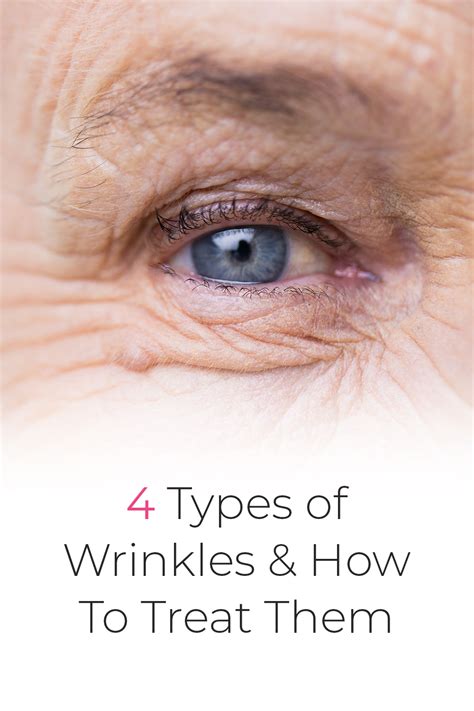 4 Different Types Of Wrinkles And My Tips For Treating Them What