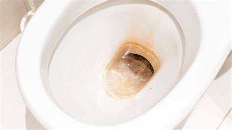 Bruine Aanslag In Je Toilet Zo Krijg Je Het Weg Radar Het