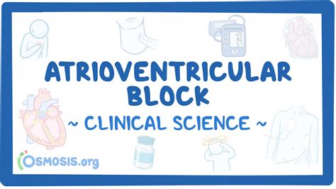 Atrioventricular Block Clinical Sciences Osmosis Video Library