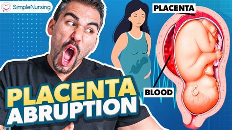 Placental Abruption Symptoms Causes Nursing Interventions Nclex