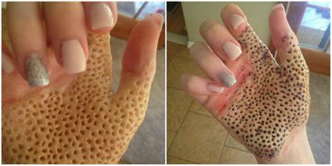 Freaking People Out Who Suffer From Trypophobia Fear Of Holes During