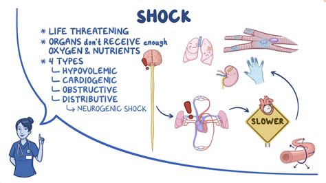 Shock Neurogenic Nursing Osmosis Video Library