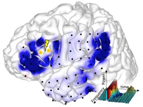 Electric Brain Stimulation Image Eurekalert Science News Releases