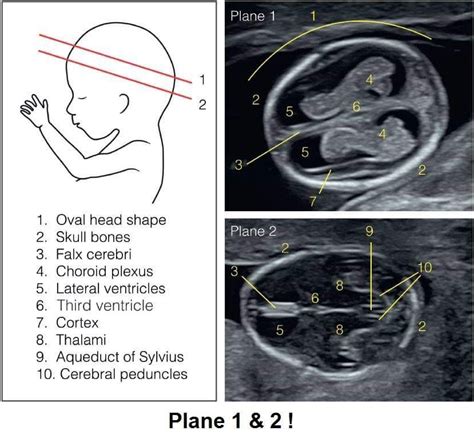 Head Ultrasound Anatomy