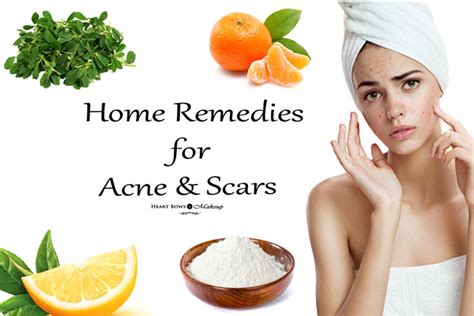 Effective Home Remedies For Acne And Scars Heart Bows And Makeup