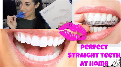 Professional Braces At Home ♡ Teeth Aligners For Straight Perfect Teeth