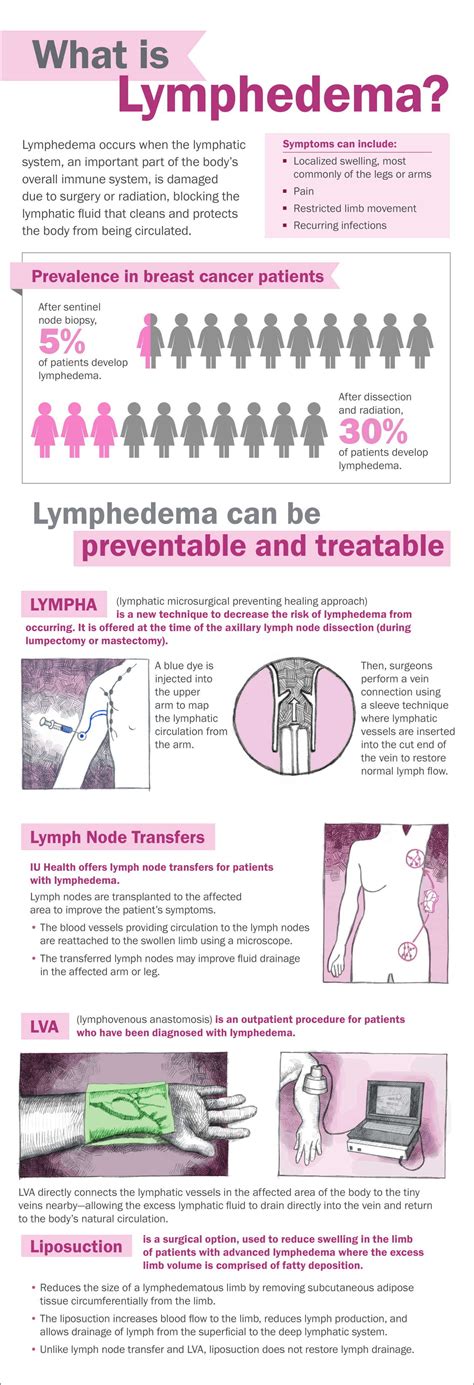 Lymphedema Treatment And Prevention Iu Health