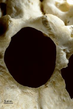 The Human Skull by Jessica Peterson