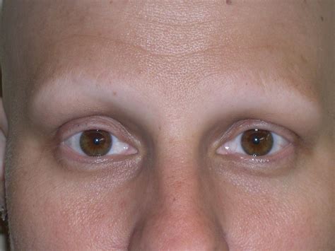 May 06, 2021 · individual lashes can be applied to both the top and bottom lashlines, but false eyelashes look most natural when only applied to the top eyelid. eyes without eyelashes - Google Search