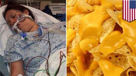 Mom Paralyzed By Botulism After Eating Nacho Cheese Sauce Video Dailymotion