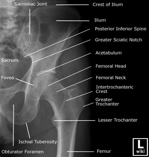 Pelvic Anatomy Xray Likes Comments The Radiologist Branches Of The Internal
