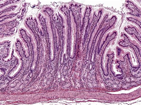 Pyloric Stomach Mucosa Lm Stock Image C Science Photo