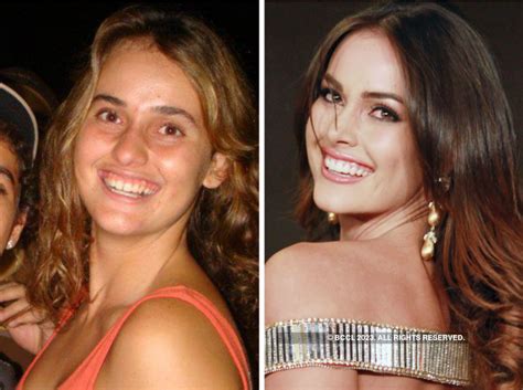 Beauty Queens Who Did Plastic Surgery Beauty Pageants Times Of