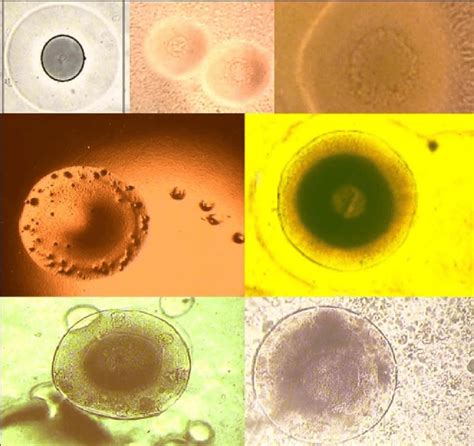 Mycoplasma Colonies In This Study X 100 Download Scientific Diagram