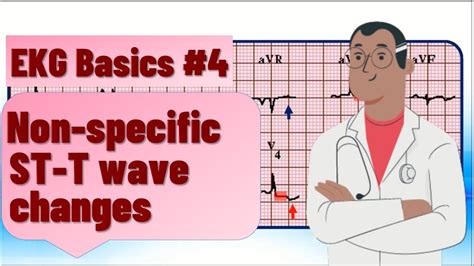 Ecg Basics Nonspecific St T Wave Changes Differential Diagnosis