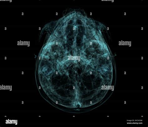 Human Base Of Skull Brain By Ct Scan X Ray Visualization Inside Of