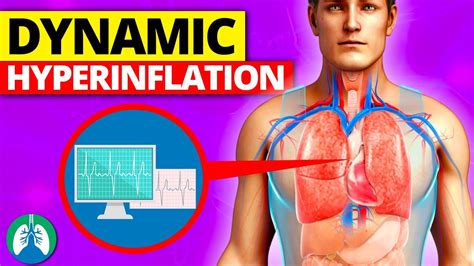 Dynamic Hyperinflation Medical Definition Quick Explainer Video