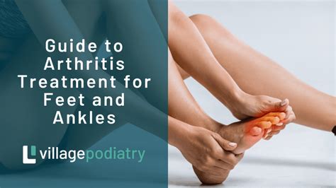 Rheumatoid Arthritis Feet Early Signs