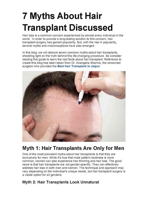 Myths About Hair Transplant Discussed Pdf Host
