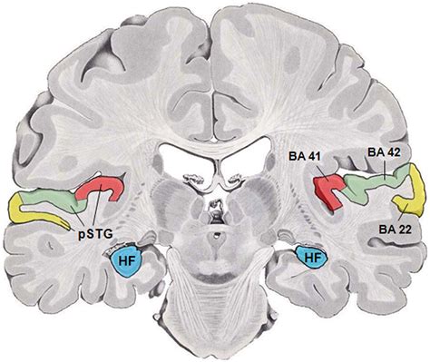 Filehuman Temporal Lobe Areaspng Wikimedia Commons