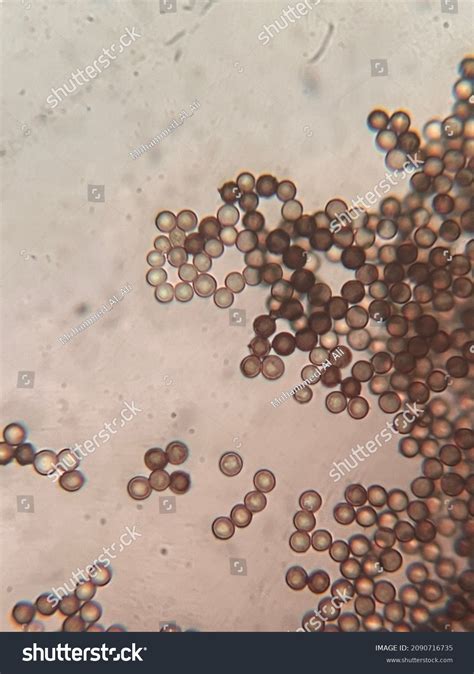 Photo Fungi Spores Under Microscope Stock Photo 2090716735 Shutterstock