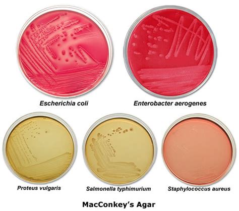 26 Best Bacteriology Practical 1 Images On Pinterest Microbiology