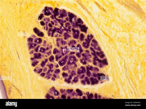Salivary Gland Light Micrograph Of A Section Through A Salivary Gland