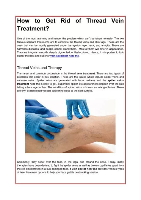 Ppt How To Get Rid Of Thread Vein Treatment Powerpoint Presentation