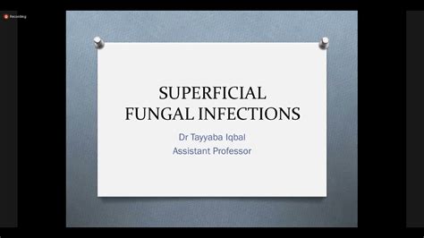Fungal Infections Dermatology Youtube