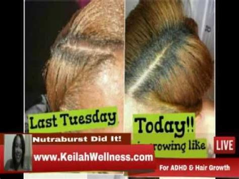 Their intake in proper proportions will ensure fast and healthy hair growth. Best Liquid Hair Vitamin For Black Women - Nutraburst ...