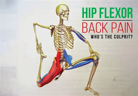 Hip Muscles Diagram Hip Injury Chart Hip Injuries Poster 9781587793837
