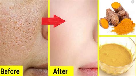 How To Get Fair And Glowing Skin Instantlyface Packface Care Youtube