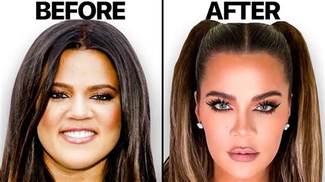 Khloe Kardashian New Face Plastic Surgery Analysis Youtube