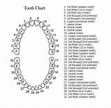 How To Do Dental Charting Pictures