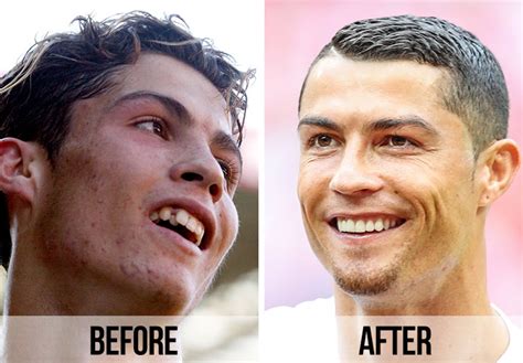 Cristiano Ronaldo Before And After