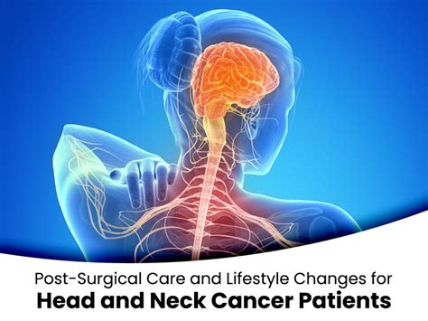 Post Surgical Care And Lifestyle Changes For Head And Neck Cancer Patients