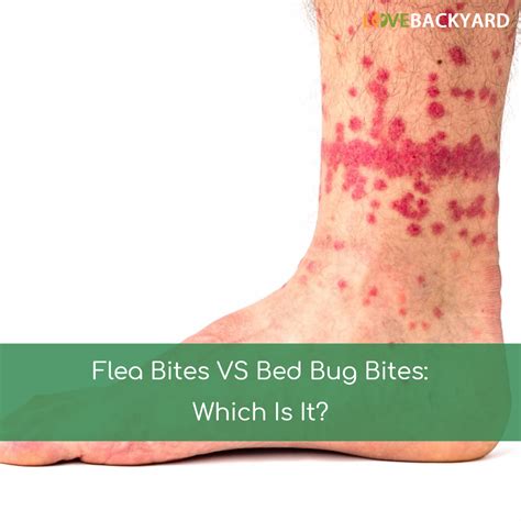 Bed bug bites and flea bites look nearly identical, as both look like a variant of a mosquito bite. Flea Bites VS Bed Bug Bite (Oct. 2019) Which Is It?
