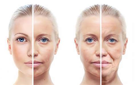 Age Management What Happens To Your Skin As You Get Older Evolve