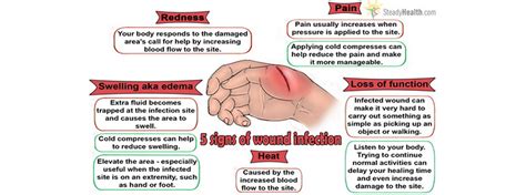 The Five Signs Of Wound Infection Injuries Fractures And Burns