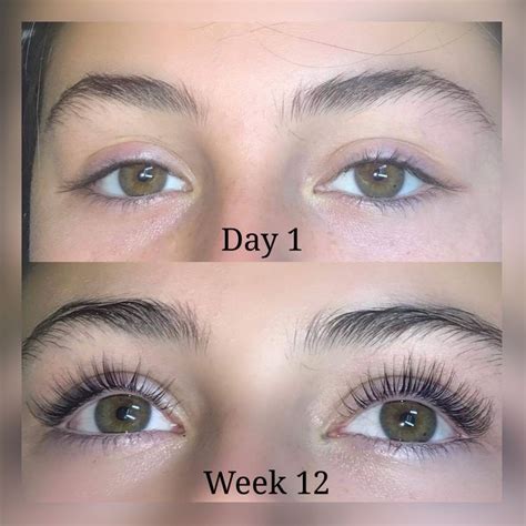 Amazing Eyelash Serum Results Before And After In 2020 How To Grow
